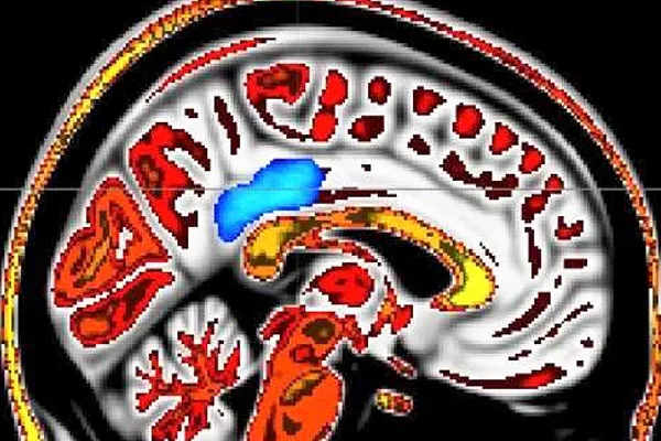 ‘Mindful people’ feel less pain; MRI imaging pinpoints supporting brain activity addiction recovery ebulletin mindful people feel less pain