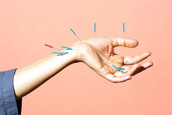 Acupuncture may help those battling addiction addiction recovery ebulletin acupuncture helps addiction