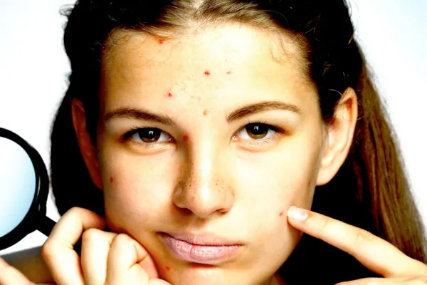 Does Your Skin Affect Your Mental Health—and Vice Versa? addiction recovery ebulletin does skin affect mental health