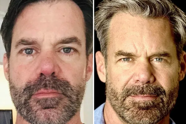 Tuc Watkins: Before and After, 4 Years of Sobriety