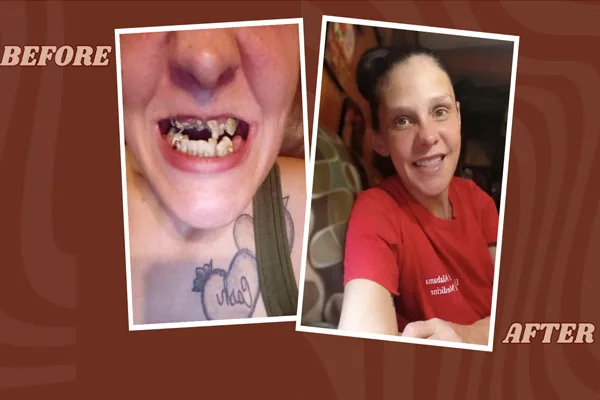 Restored Smiles Gives Addicts a New Lease on Life