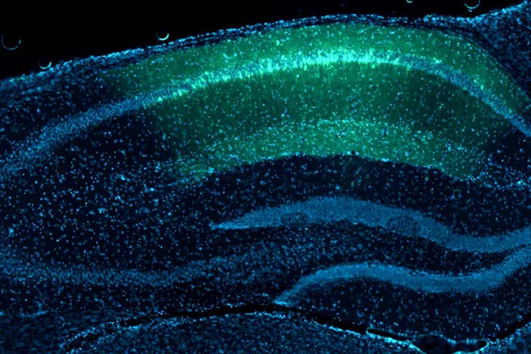 The Brain’s Reward Network Could Explain Addiction