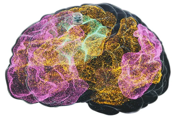 Brain Implant for Depression Is About to Be Tested in Humans
